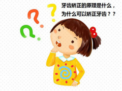 【福州】牙齿矫正是根据什么原理，矫正时间受