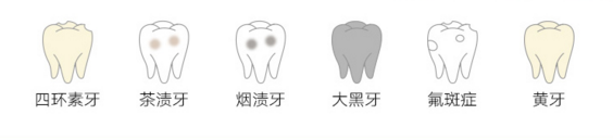 外源性着色牙是怎么回事，有没有办法白回来？