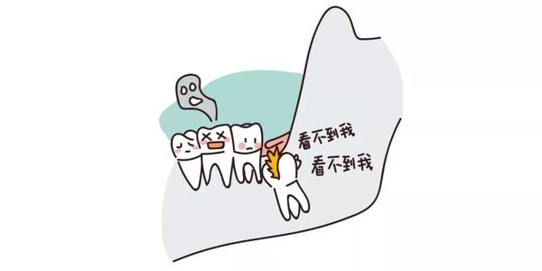 【福州】如何判断自己长了智齿？