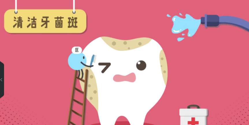 【福州】什么是牙菌斑?该怎么去除它?