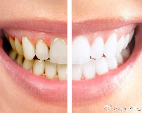 冷光美白后为什么牙齿会有酸痛感？正常吗？