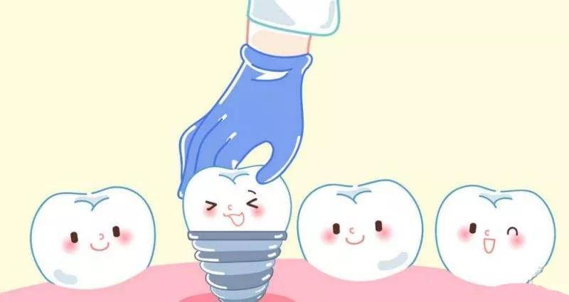 【福州】种植牙有什么优点？