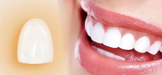 【福州】牙齿美白究竟选哪种方法伤害最小呢?