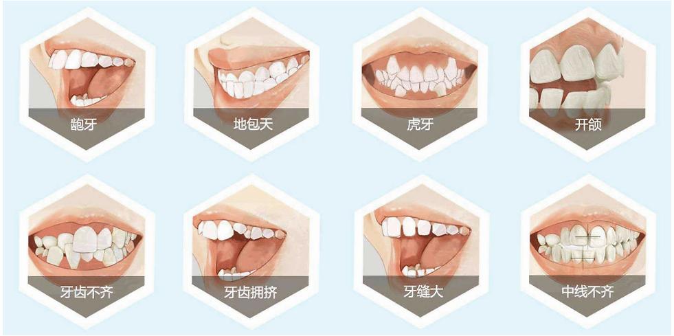 福州口腔医院科尔口腔今天就来跟您聊聊那些关于牙齿矫正的问题.