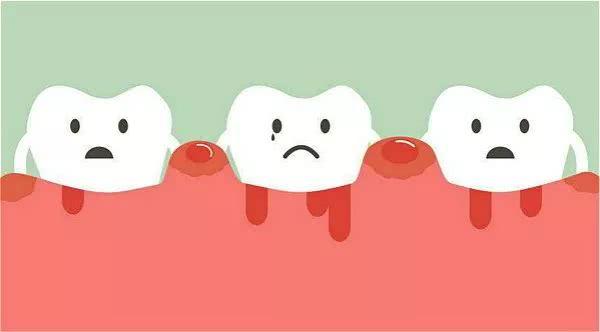 【福州】牙周疾病是怎样的？该如何预防？