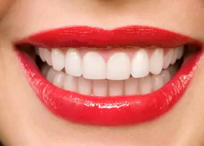 【福州】牙齿冷光美白有什么好处和优点？