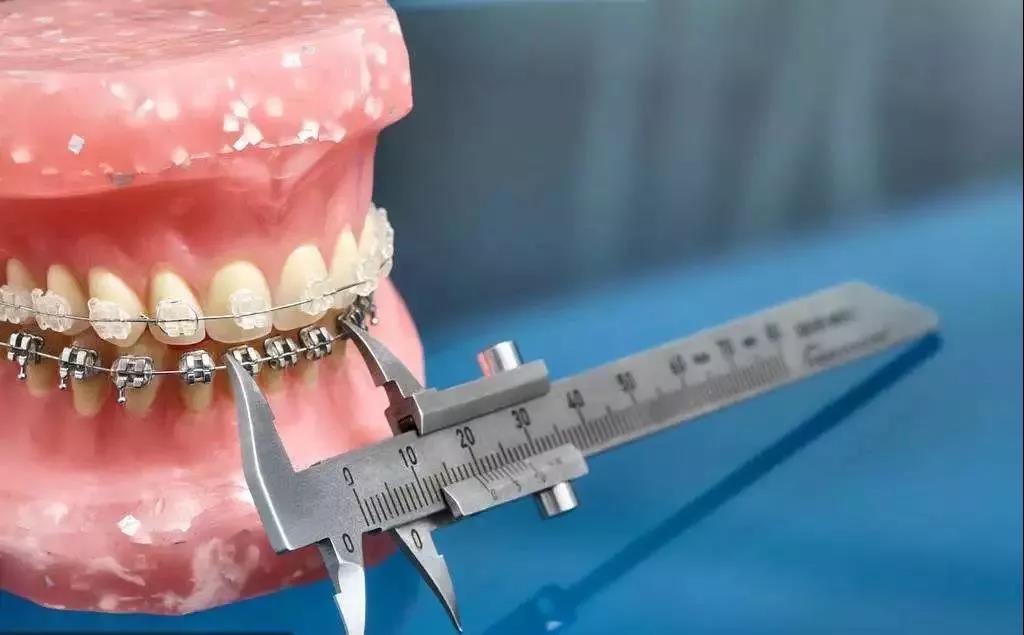 【福州】牙齿矫正的流程，你都清楚吗？